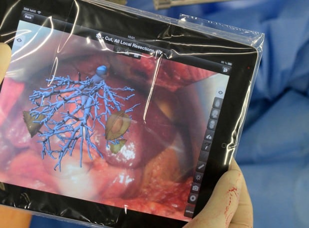 The surgeons used the augmented reality app through an iPad